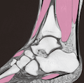 足関節MRI(矢状断像-右側)