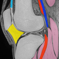 膝MRI(矢状断像)の正常解剖
