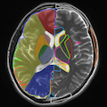 Head MRI(axial)
